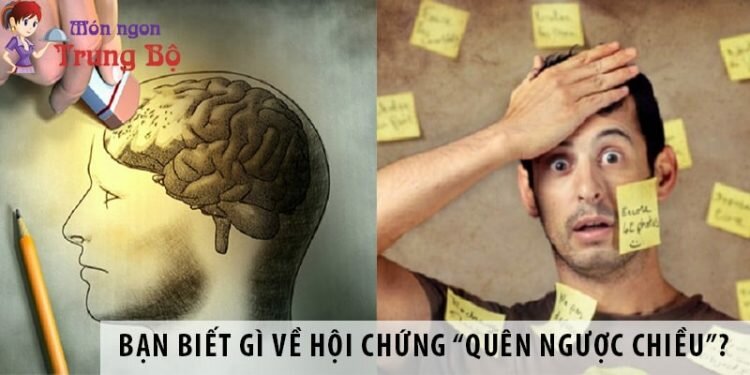 Bạn biết gì về hội chứng “quên ngược chiều”?