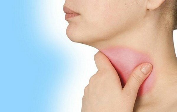 dấu hiệu của bệnh tuyến giáp 1