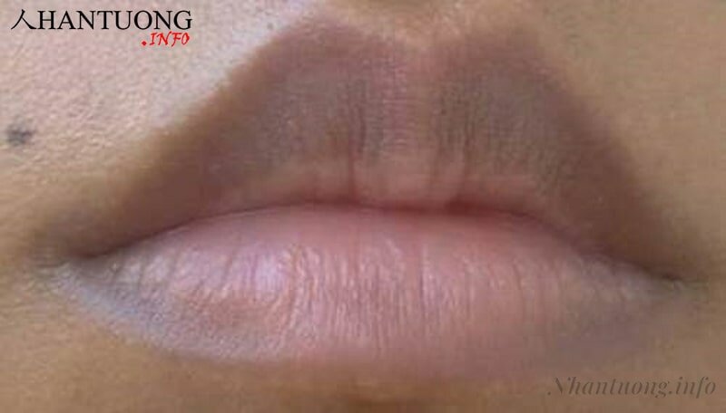 Hình dáng tướng miệng có khóe môi trễ xuống Hình dáng tướng miệng có khóe môi trễ xuống