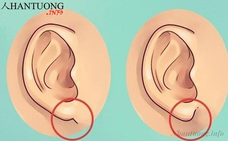 Tướng thùy tai nhỏ Tướng thùy tai nhỏ