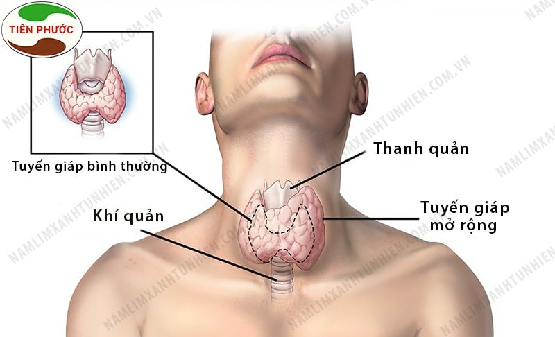 Vị trí tuyến giáp Vị trí tuyến giáp