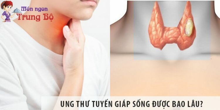 Bị bệnh ung thư tuyến giáp sống được bao lâu?